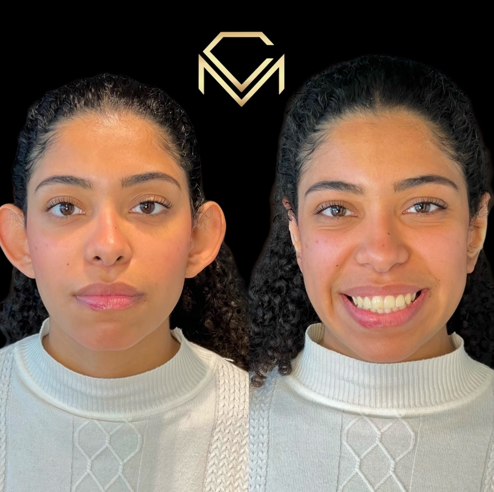 Photoroom_20250111_171139 1